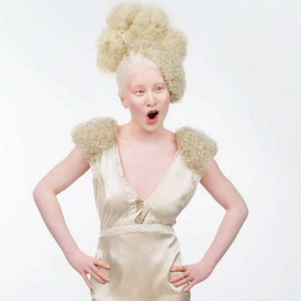 How a girl with albinism from a Chinese orphanage became a model for Vogue