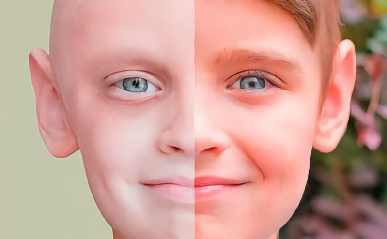 A method for detecting cancer before a tumor appears