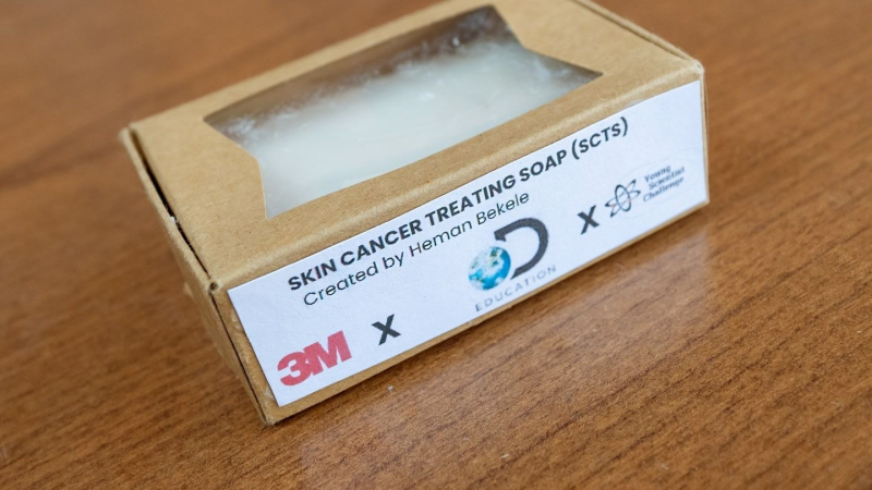 A schoolboy created a soap to fight skin cancer and received $25 thousand (photo)