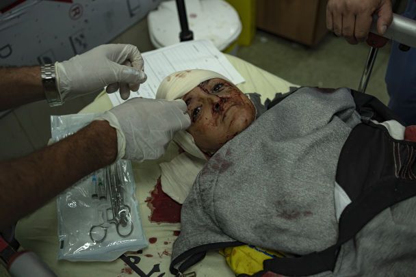 War at the gates of Al-Shifa: why Israel storms Gaza's main hospital (photo, video)