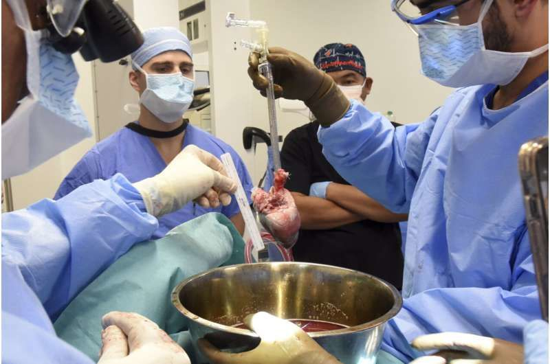 The second man in history to receive a pig heart transplant died 6 weeks after the operation (photo)