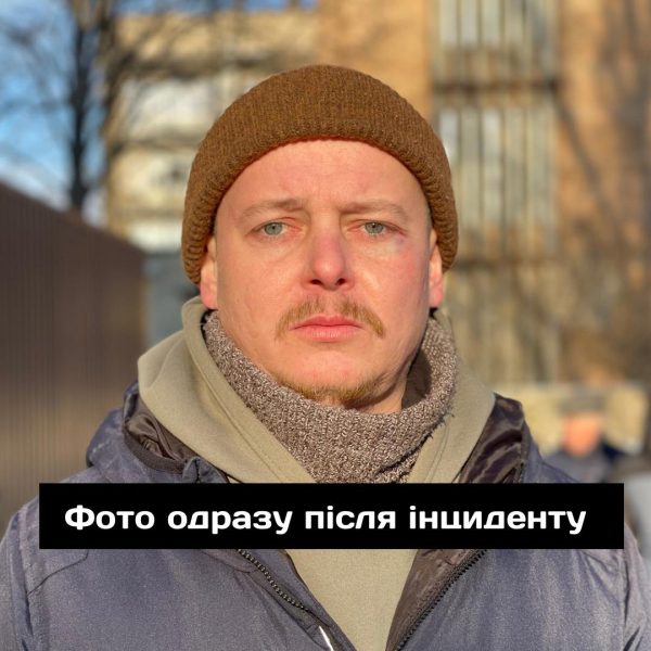 В Днепре избили известного актера: что об этом известно и что говорят в полиции