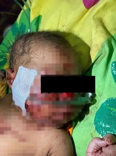 Всю ночь была под землей: новорожденная чудом выжила после того, как мама похоронила ее заживо (фото)